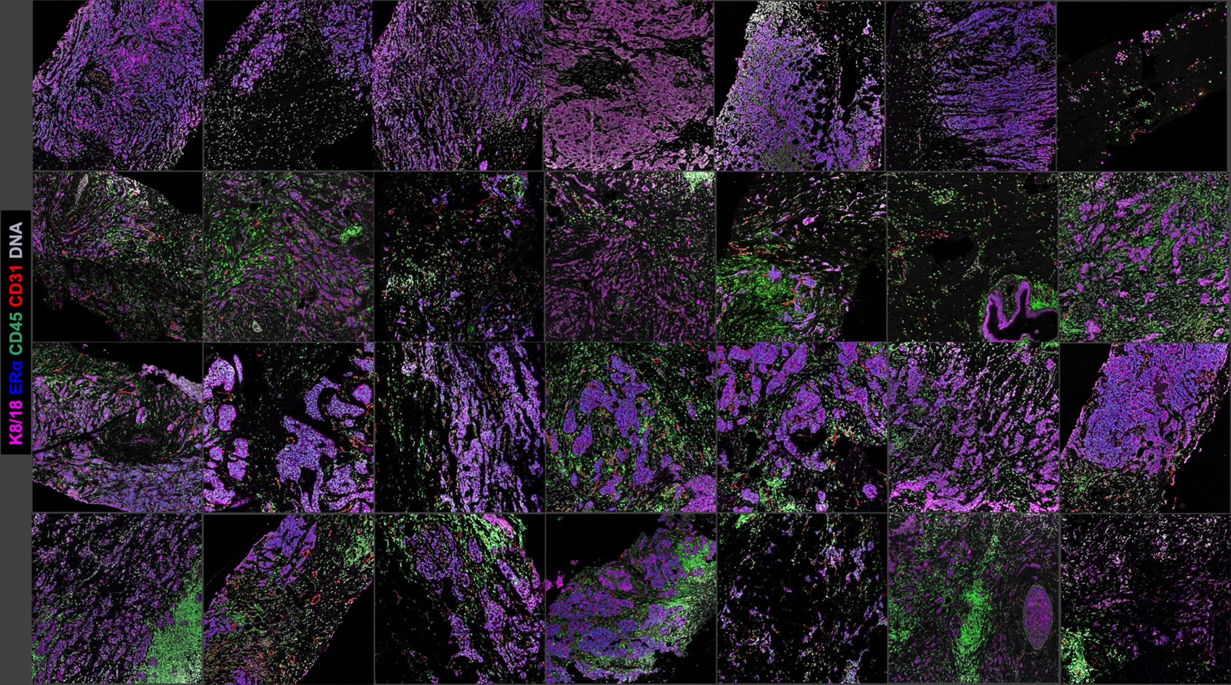 Personalised Cancer Therapy