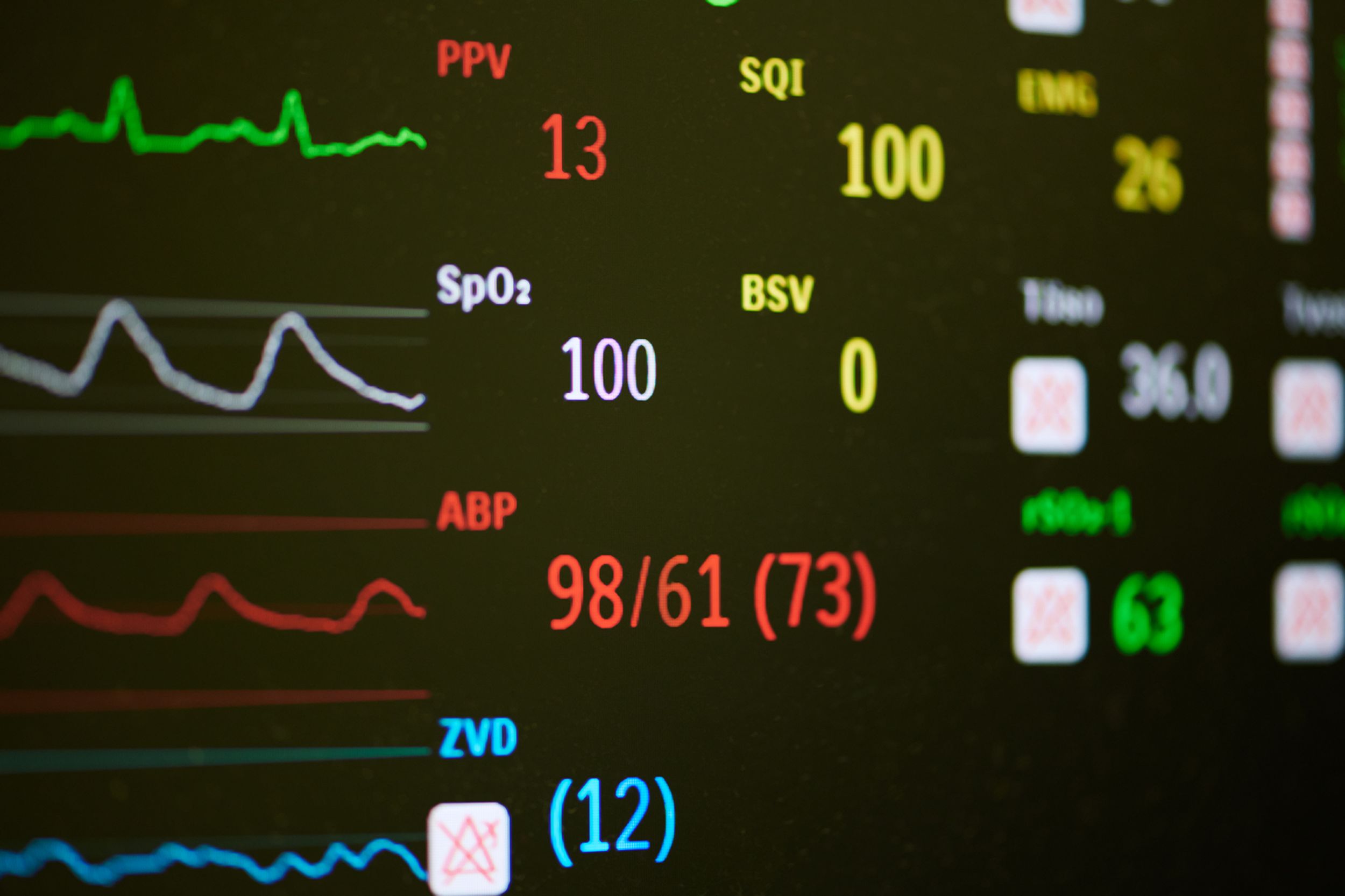 Ein Bildschirm mit Vitalwerten