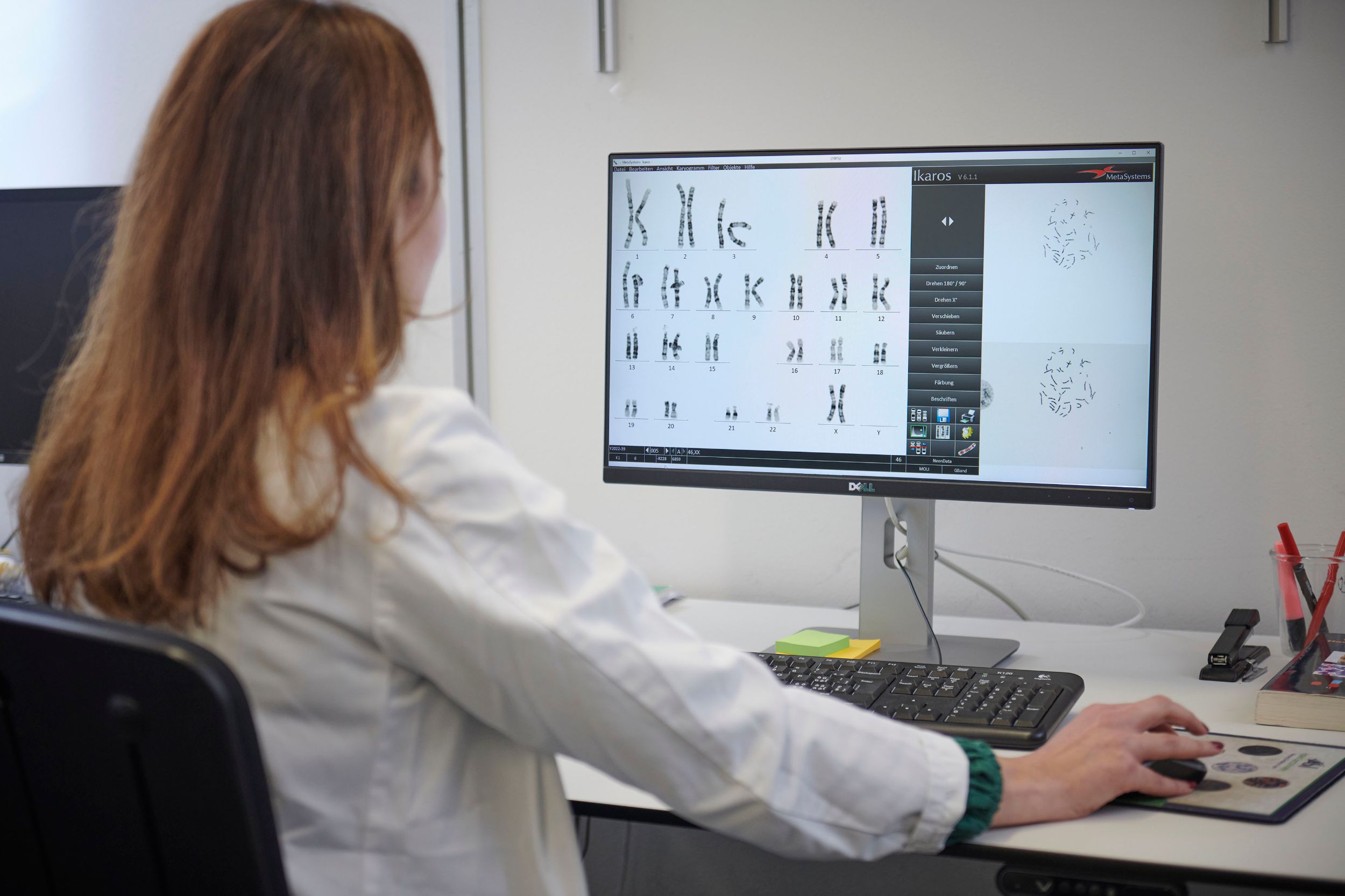 Mitarbeiterin der Med. Genetik sitzt vor Computer