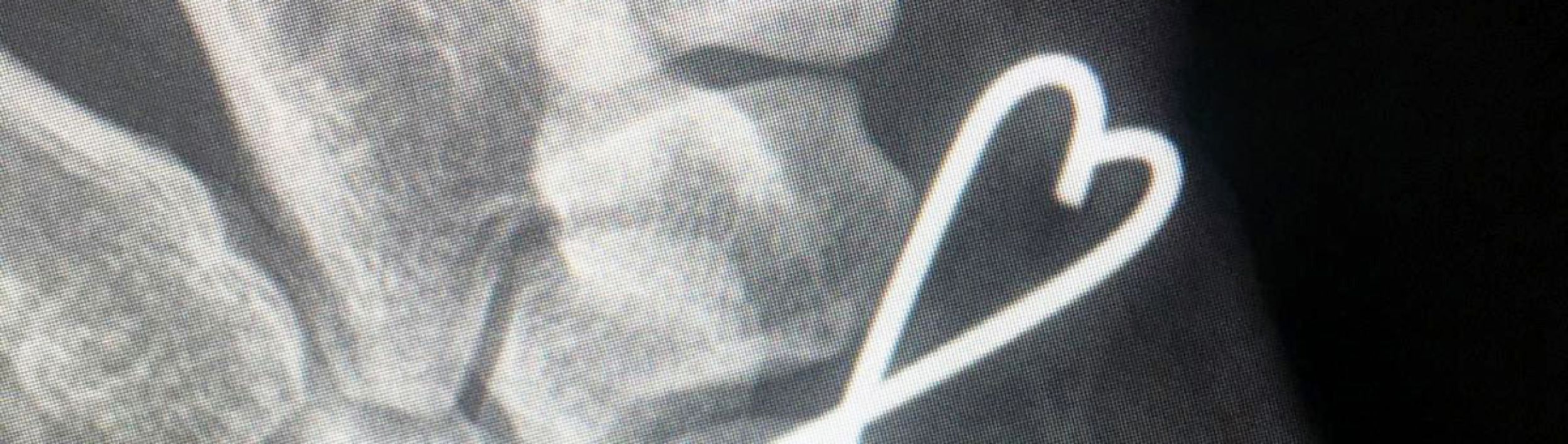 Radiologie-Scan mit einem Herz