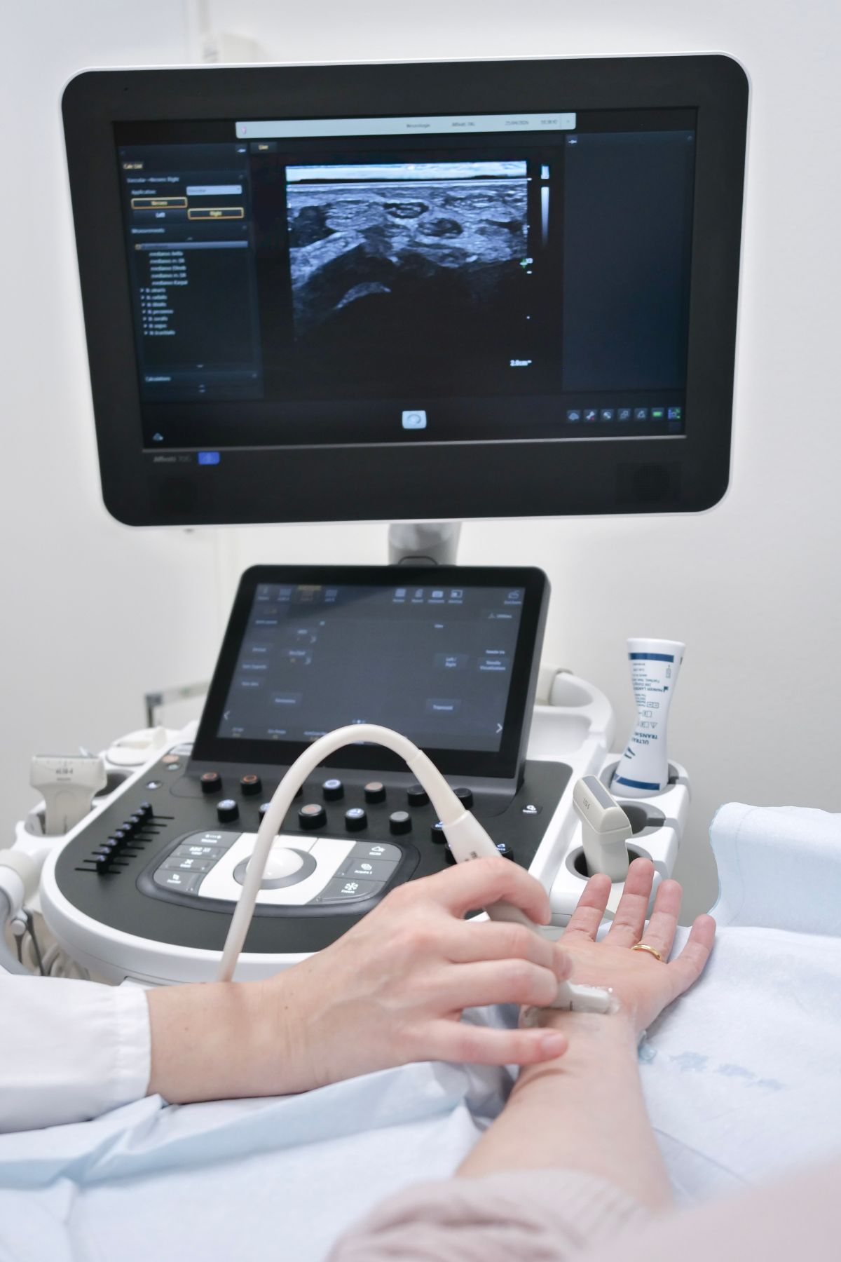 Neuromuskuläre Erkrankungen inkl. Elektroneuromyographie