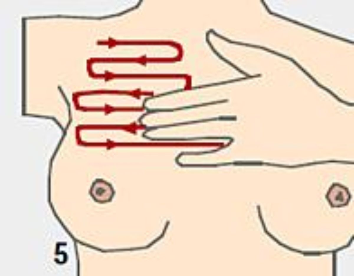 Representation of a breast