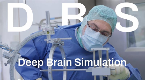   Deep Brain Stimulation, DBS