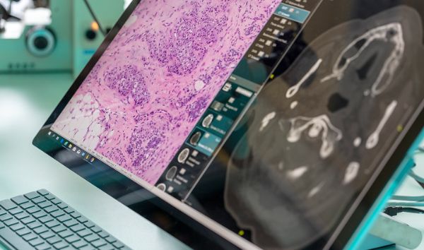 Digitale Präzisionsmedizin am USB: Innovations-Focus Klinische KI gestartet