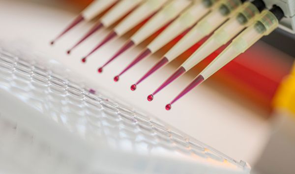 Metagenomische Next-Generation-Sequenzierung zellfreier mikrobieller DNA (mcfDNA) zur Erreger-Identifikation