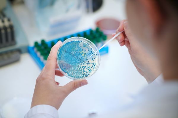 Aktuell wird im Kanton Basel-Stadt ein gehäuftes Auftreten der sogenannten Legionärskrankheit festgestellt. Dabei handelt es sich um Lungenentzündungen, die durch das Bakterium Legionella pneumophila verursacht werden. Das Gesundheitsdepartement hat die Bevölkerung über die Krankheit informiert.