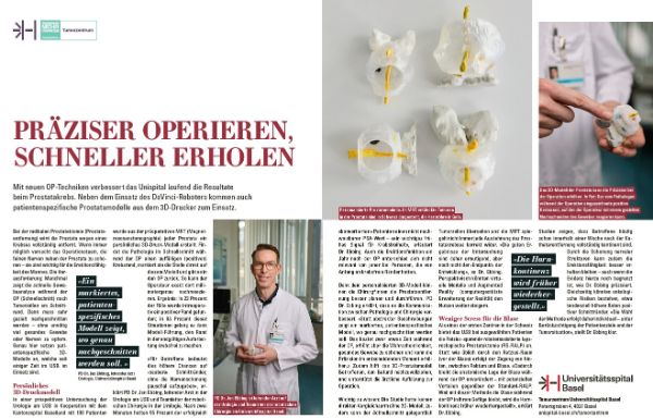 Mit neuen OP-Techniken verbessert das Unispital laufend die Resultate beim Prostatakrebs. Neben dem Einsatz des DaVinci-Roboters kommen auch patientenspezifische Prostatamodelle aus dem 3D-Drucker zum Einsatz.